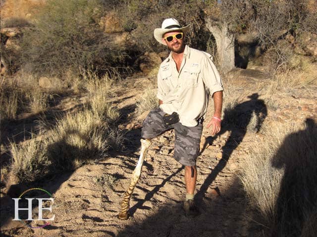 Zachary's prosthetic zebra leg in Namibia - HE Travel